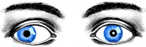 exotropia.gif